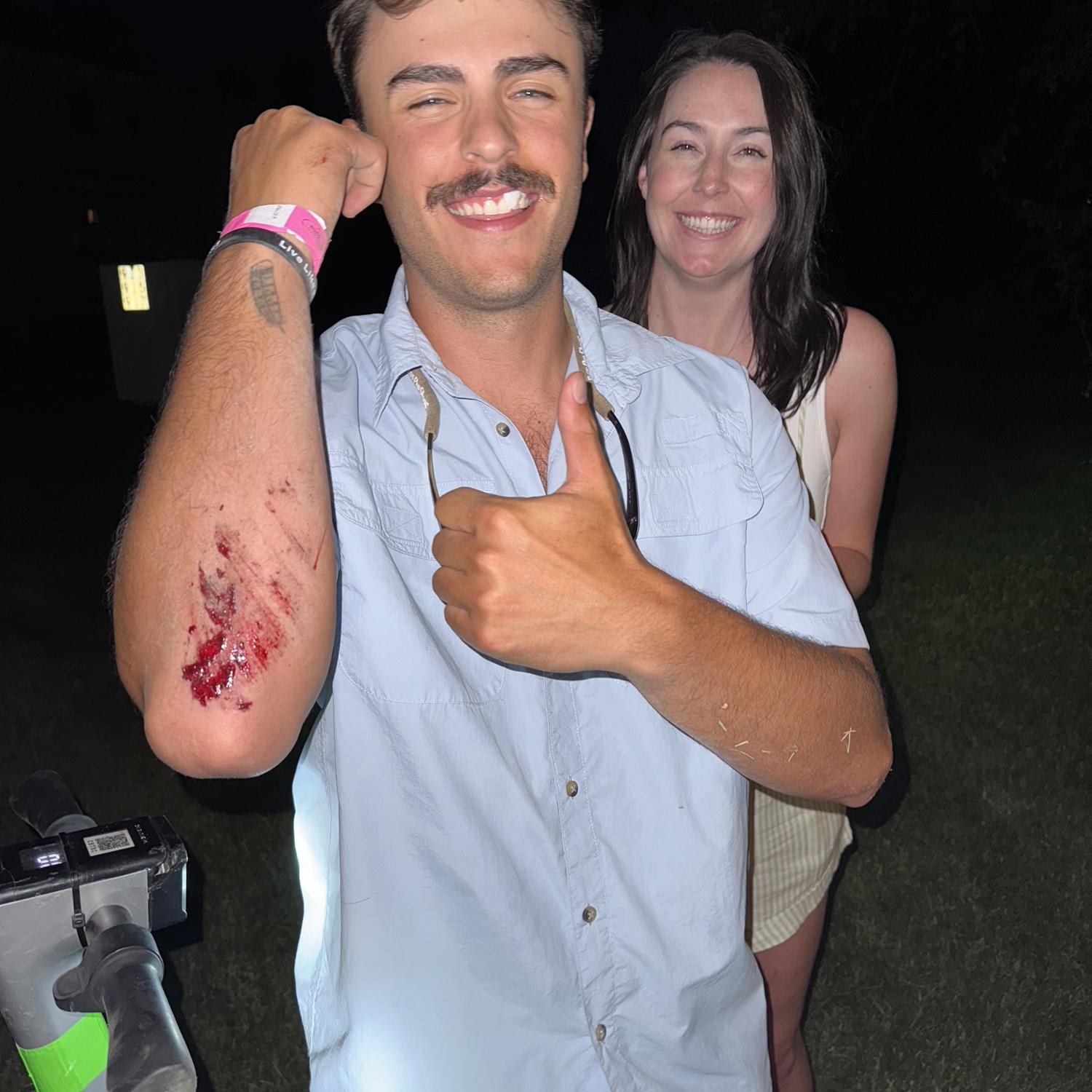 Walker took a little tumble while scootering home after music on main