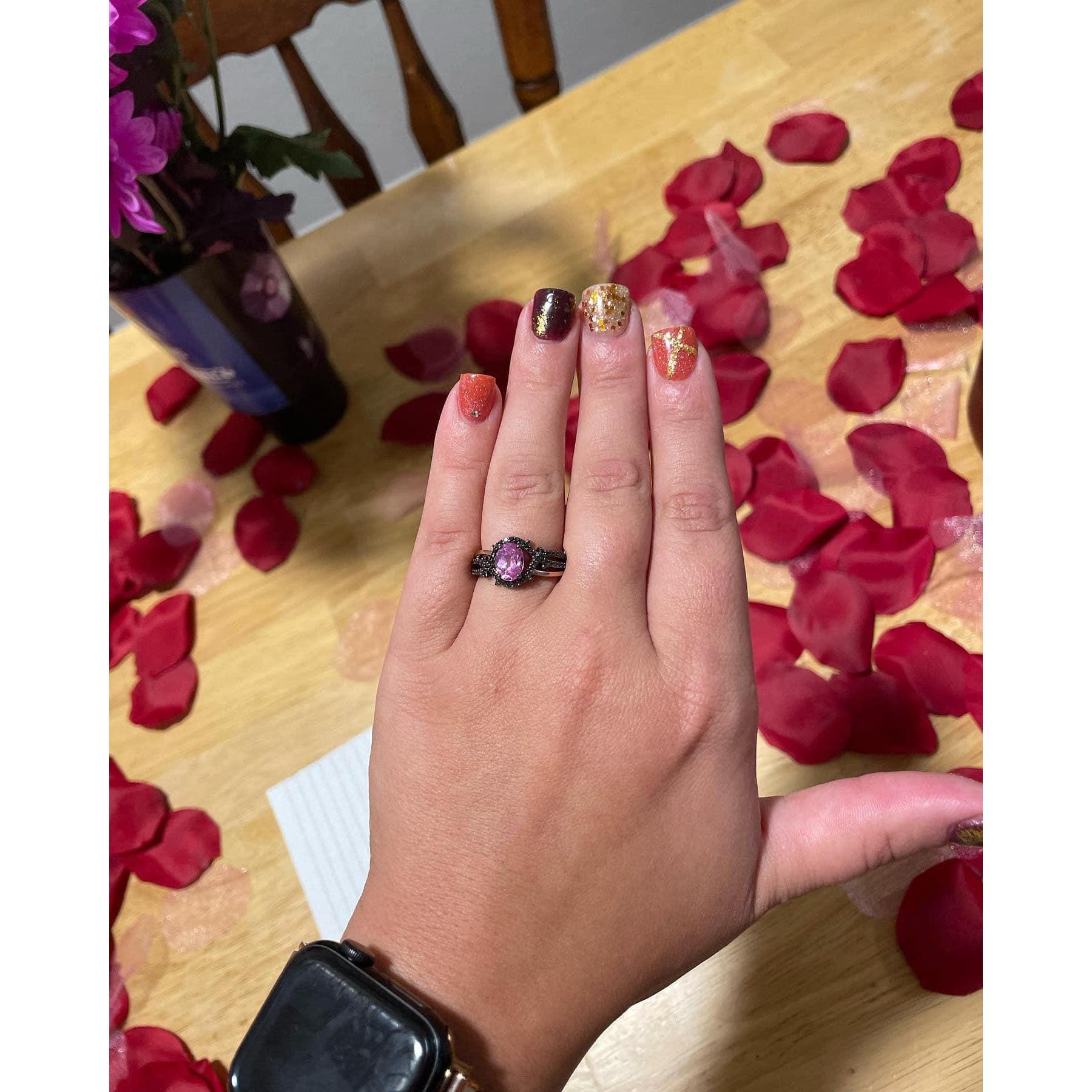 The beautiful engagement ring!