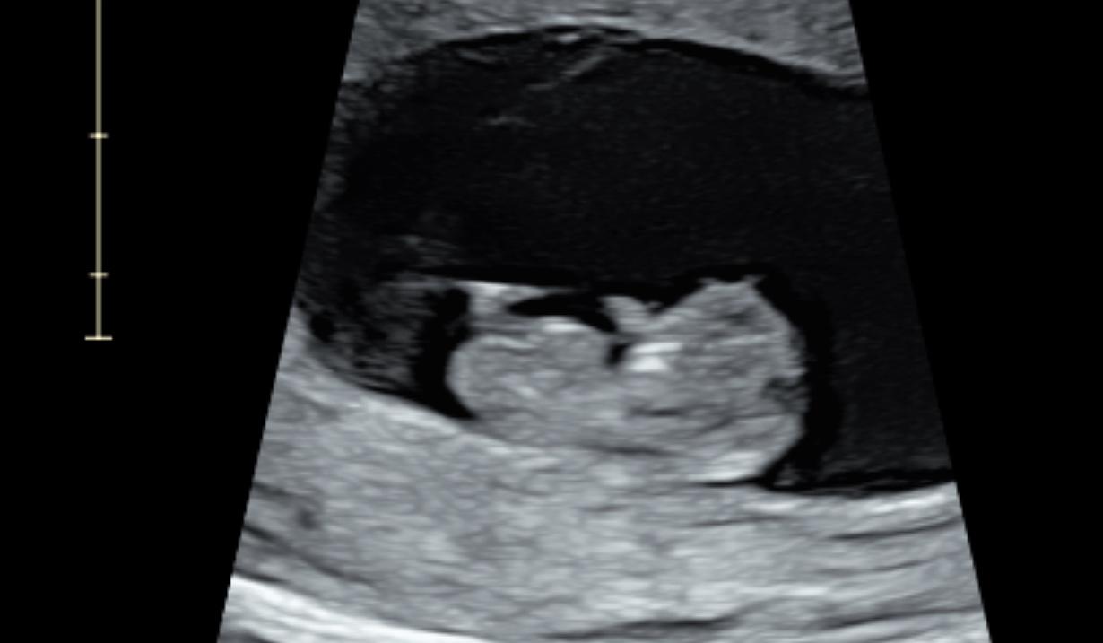 The Wedding Website of Diana Estrella and Sergio Taveras