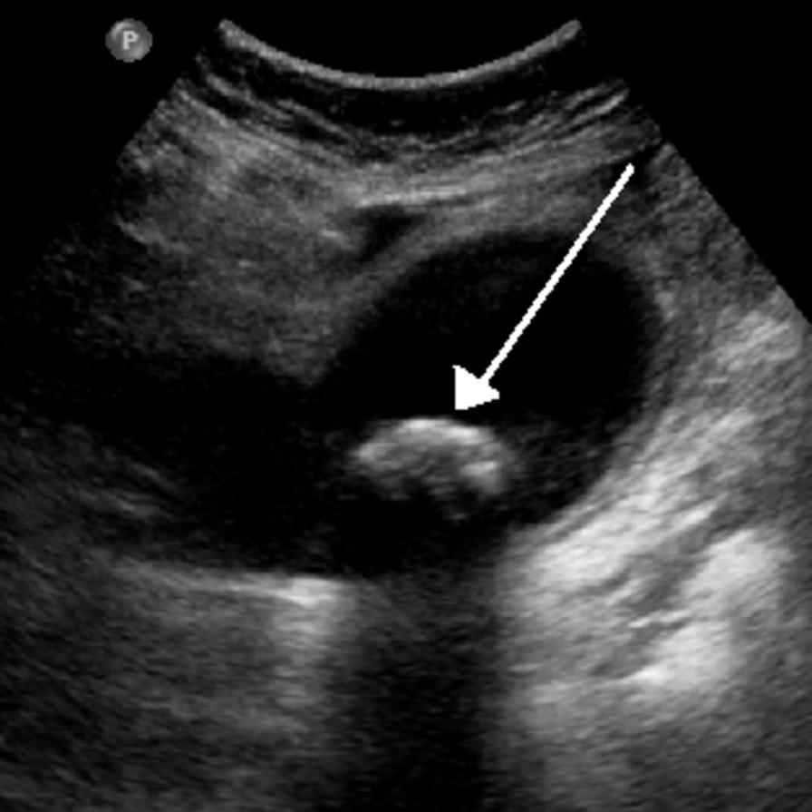 Help us afford to have children