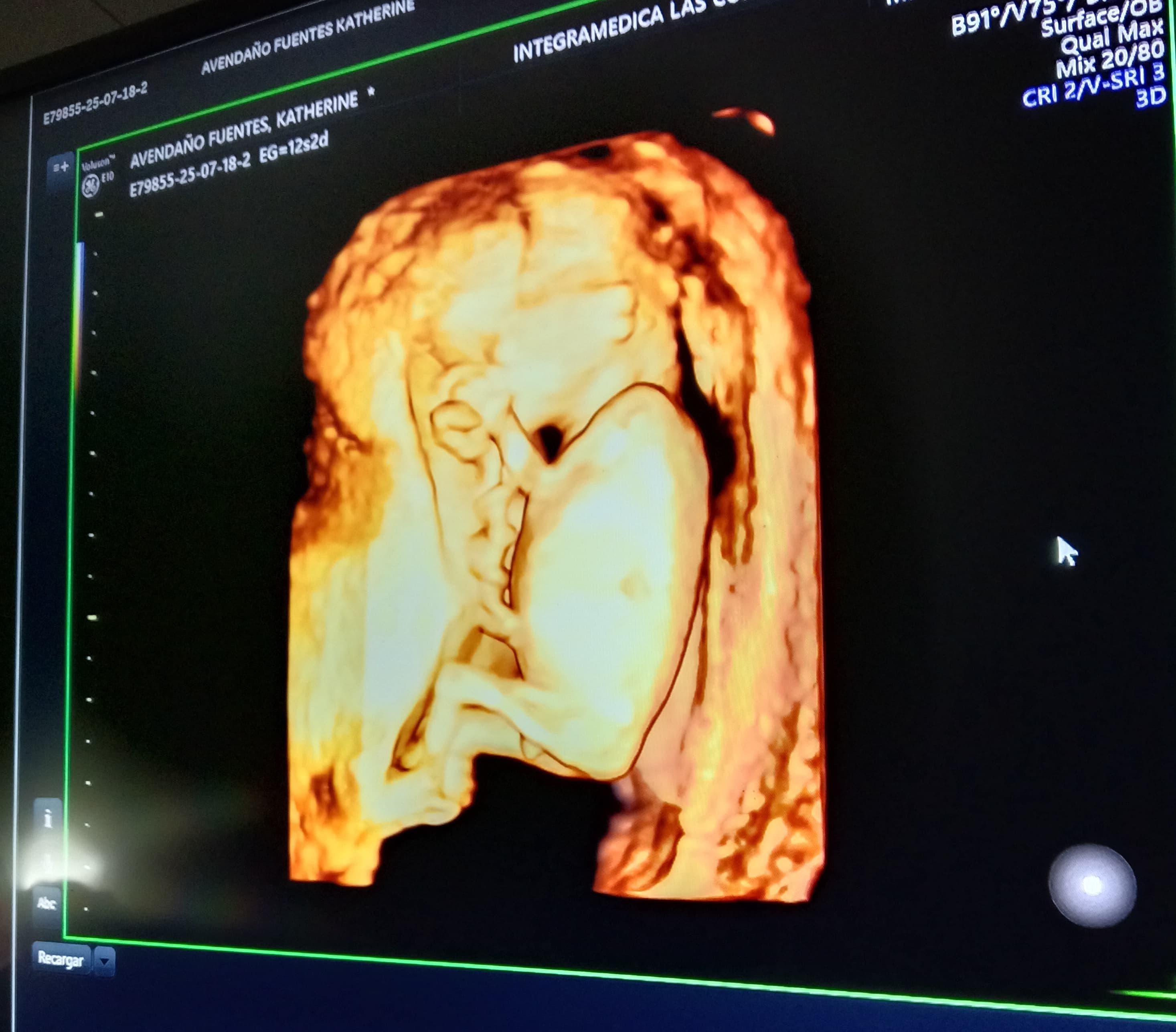 The Wedding Website of Ella Abraham and Baby Shower