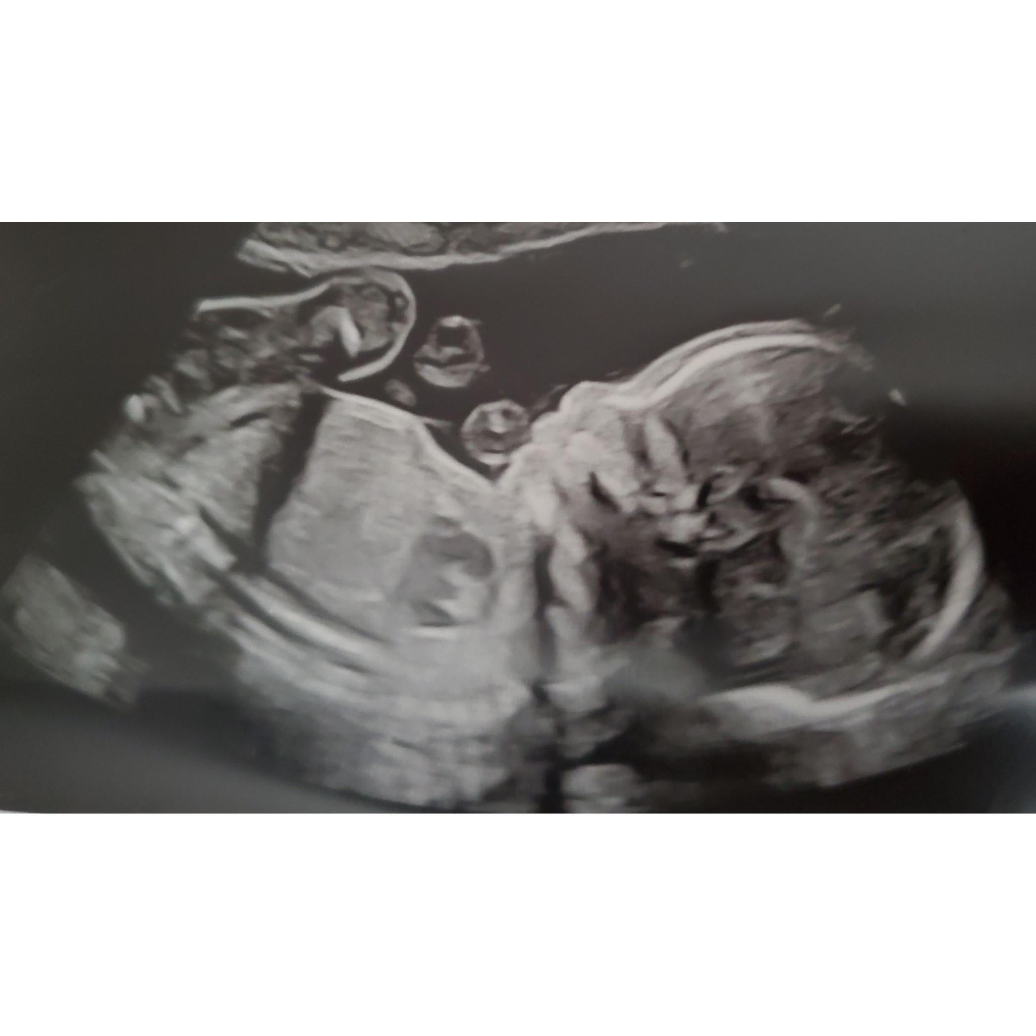 20 week ultrasound!