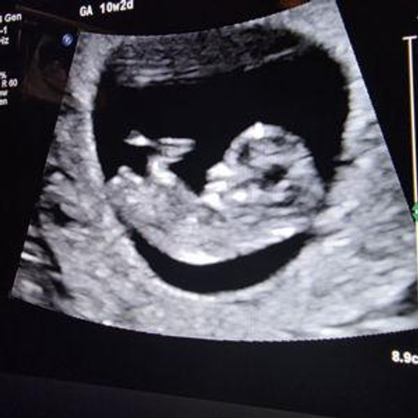 baby and house fund