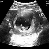 July 2024