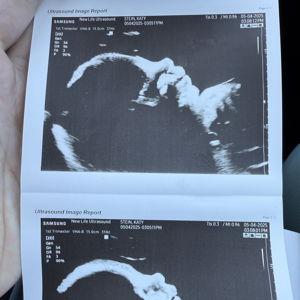 A baby boy is on the way!