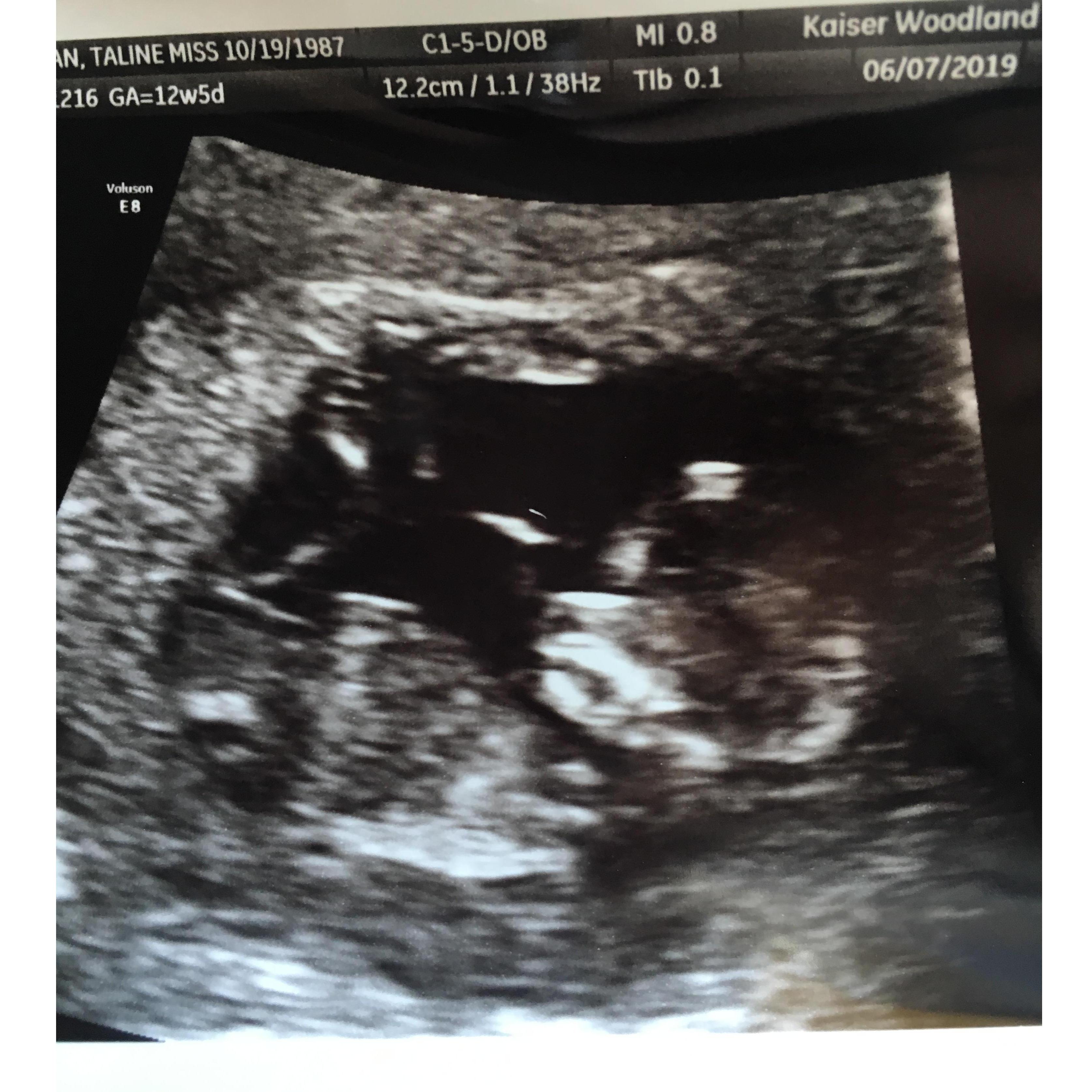 Our little bean
