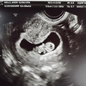 We're having a baby!