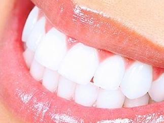 Teeth Whitening Before the Wedding