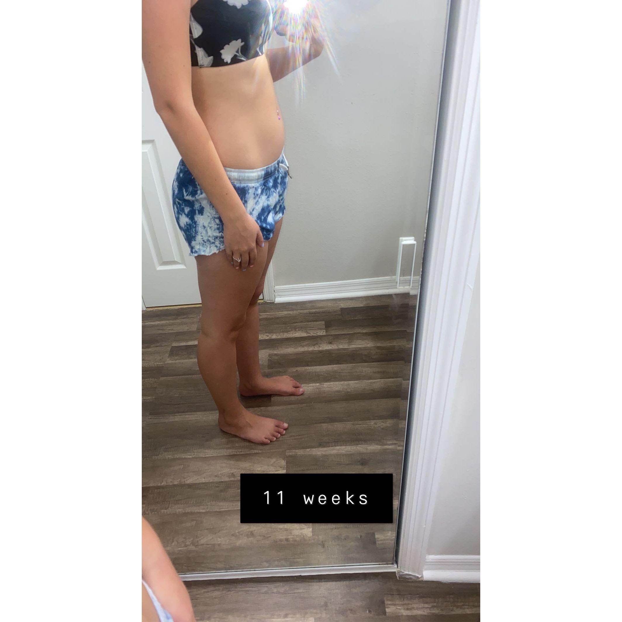11 weeks Pregnant