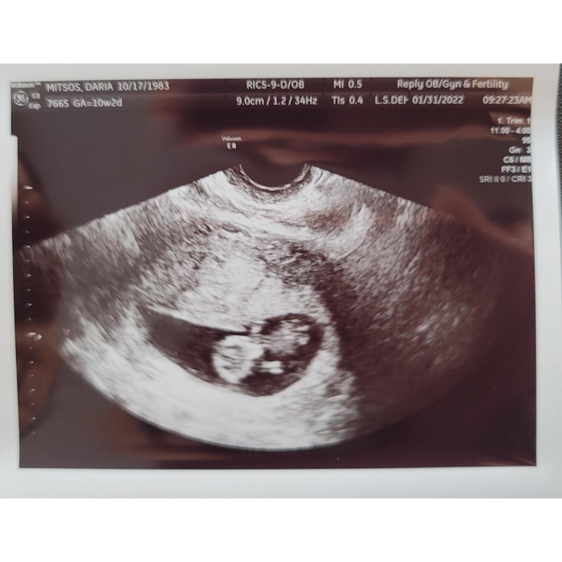 Baby Beddard due in August of 2022