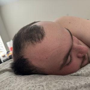 David's Hair Transplant ( Turkey Trip )