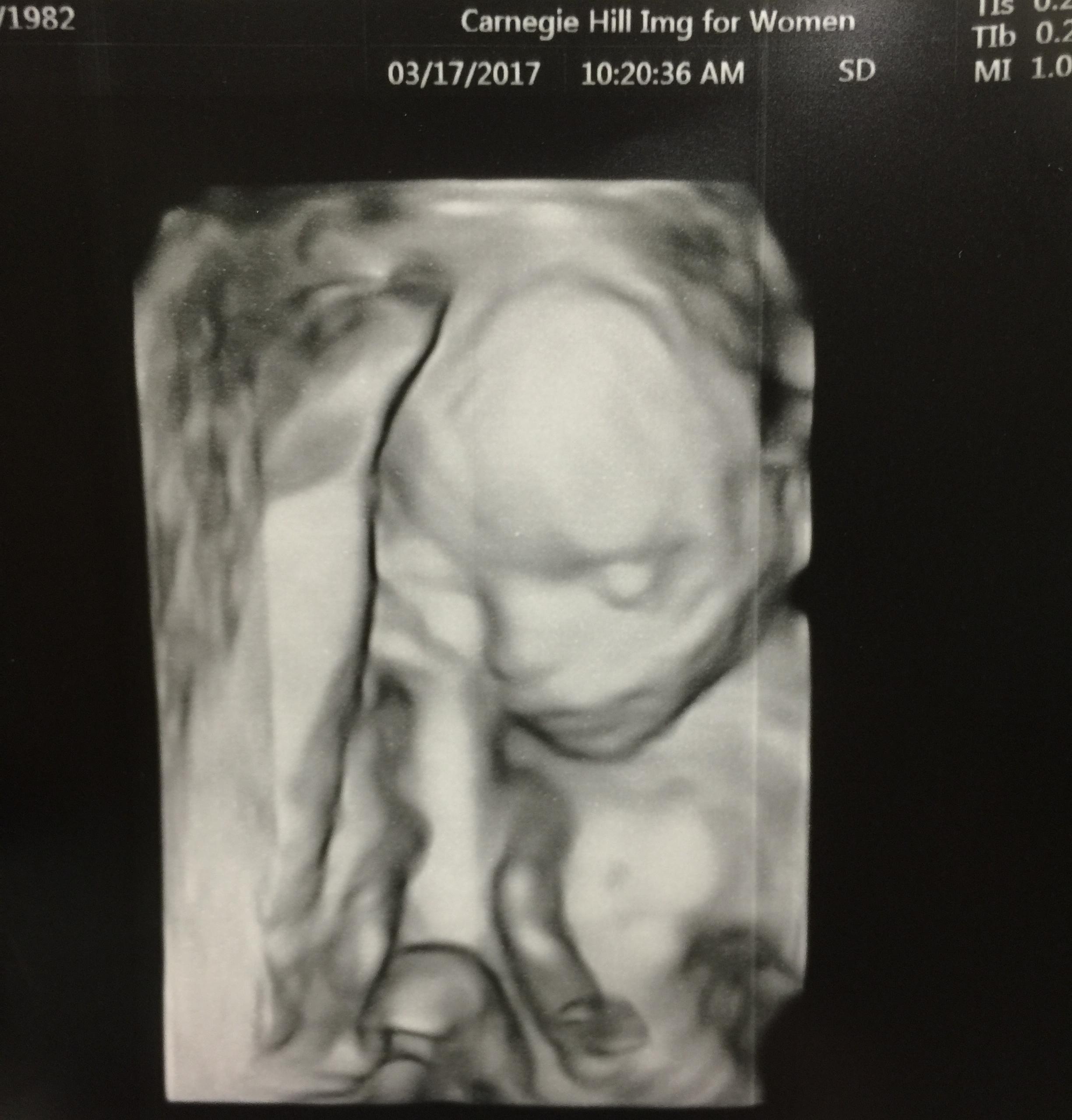 First time seeing our precious little boy's face! I had no idea we'd get these special 3-D images. It was so special to not only have Jeremy there, but also my mama was in town from Savannah.