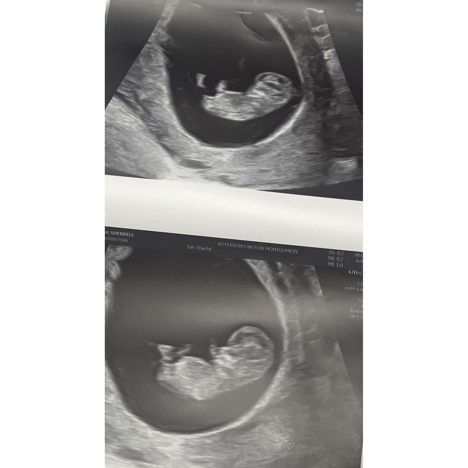 8 weeks