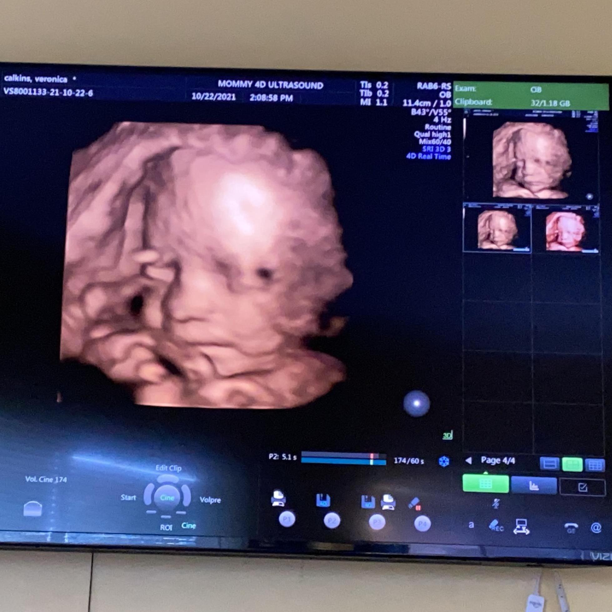 28 weeks!  There he is!!!