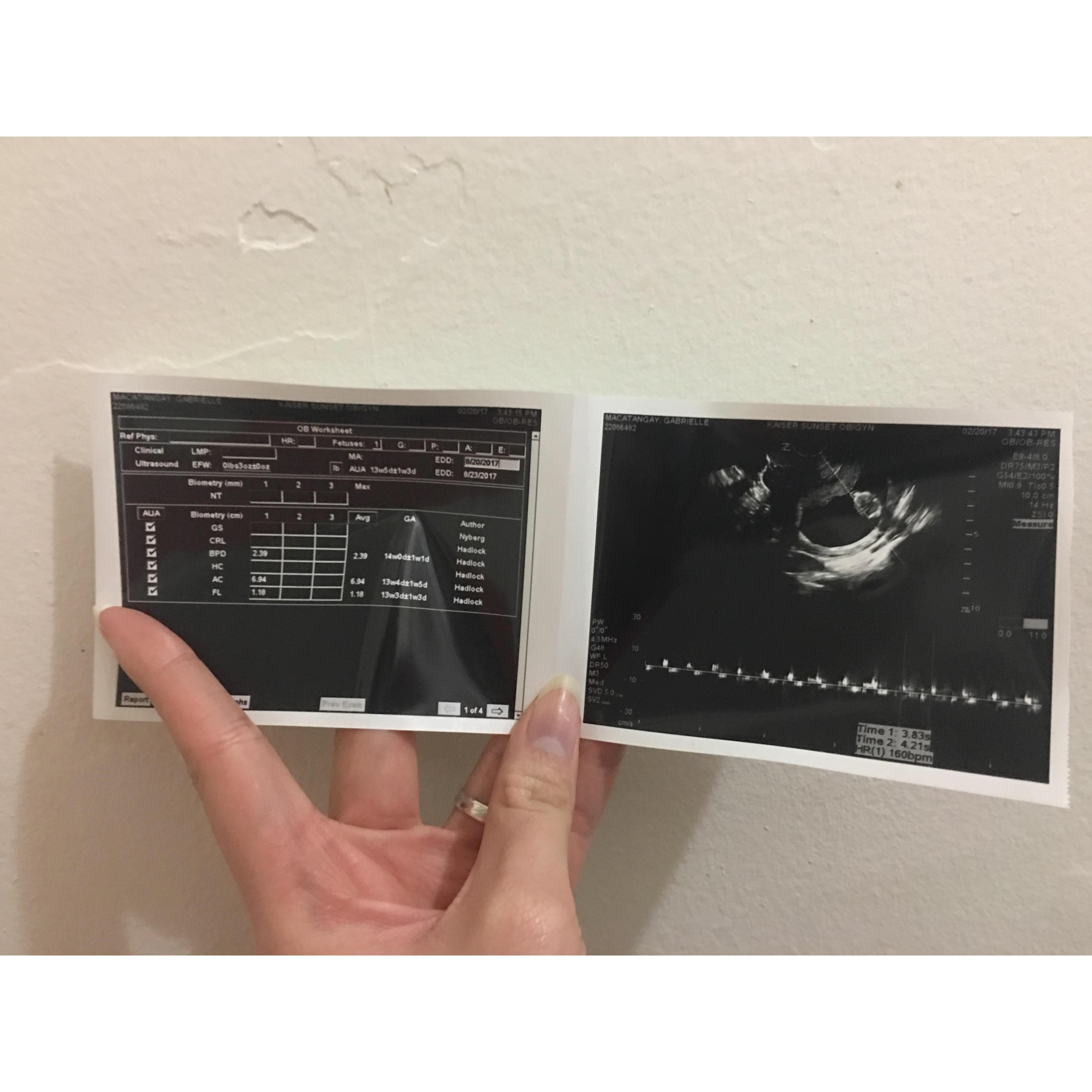 One and a half year we received our beautiful blessing!