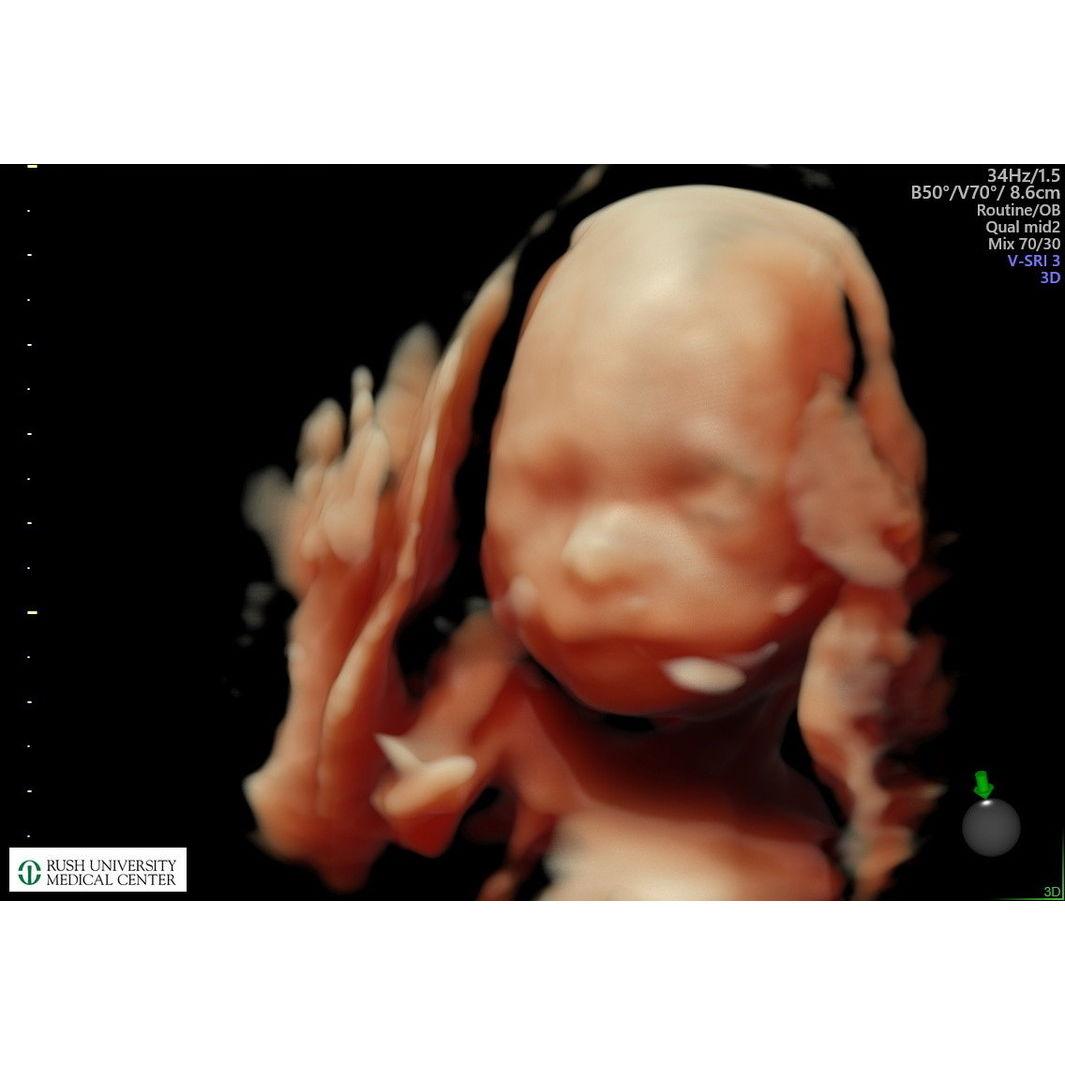 Little Baby Girl