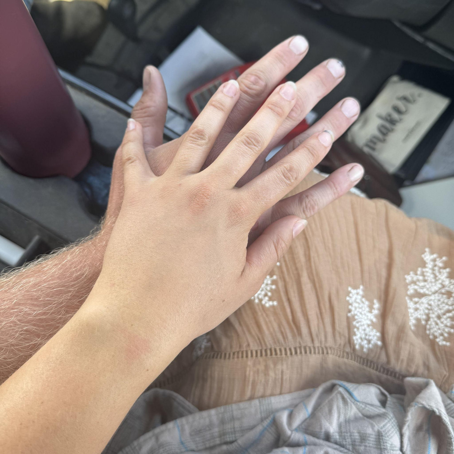 Jake trying to prove he's tanner than Melody but we all know that's not true.