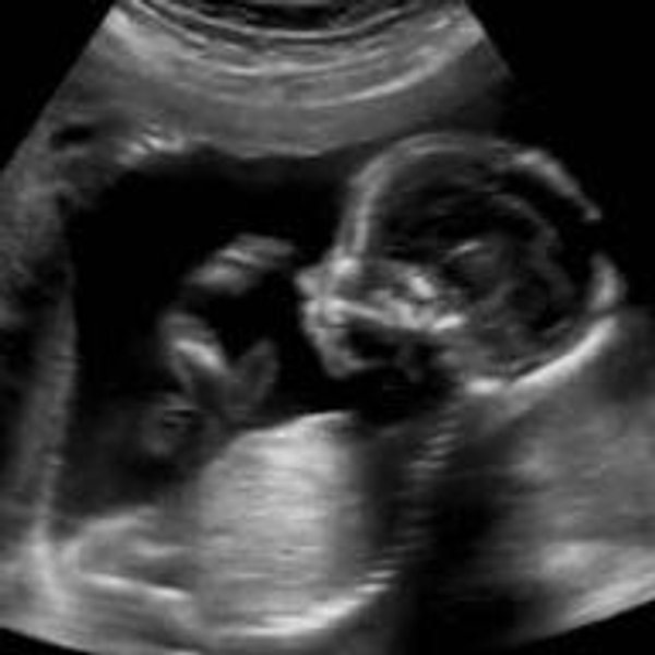 Our Midwifery Fund
