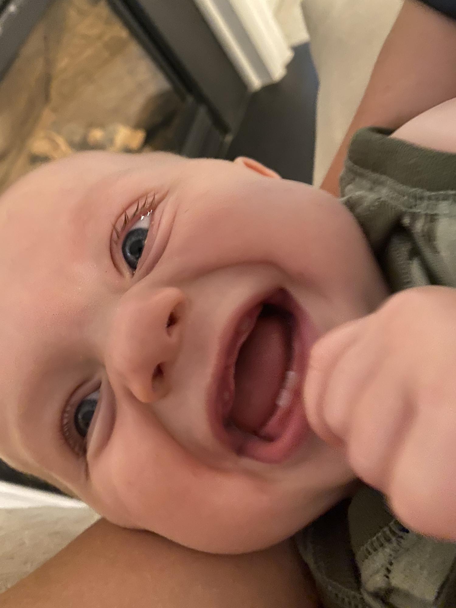 2 more teeth coming