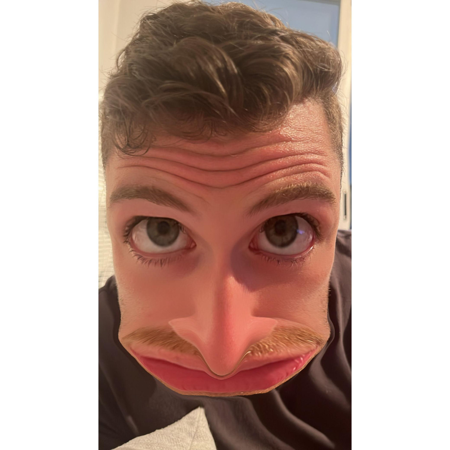 Eric post-facial reconstruction surgery