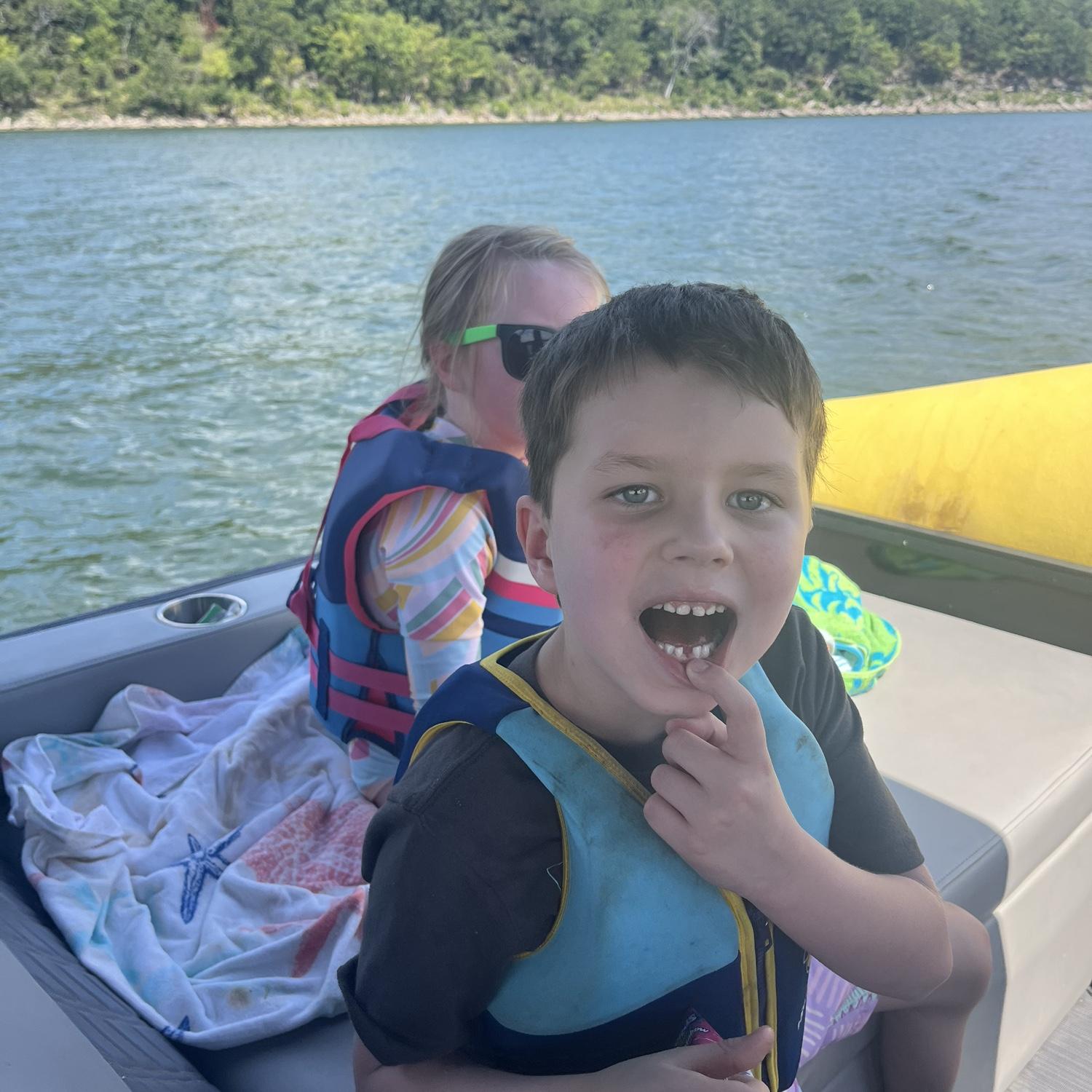 Jameson lost his first tooth