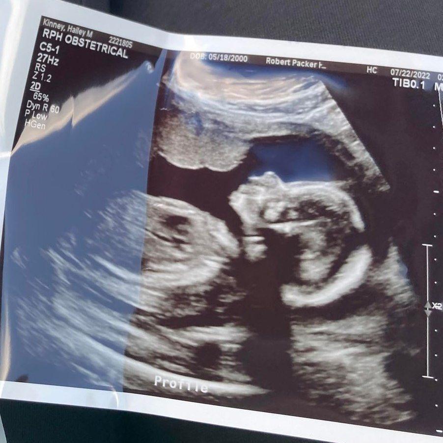 Baby #2 is on the way
