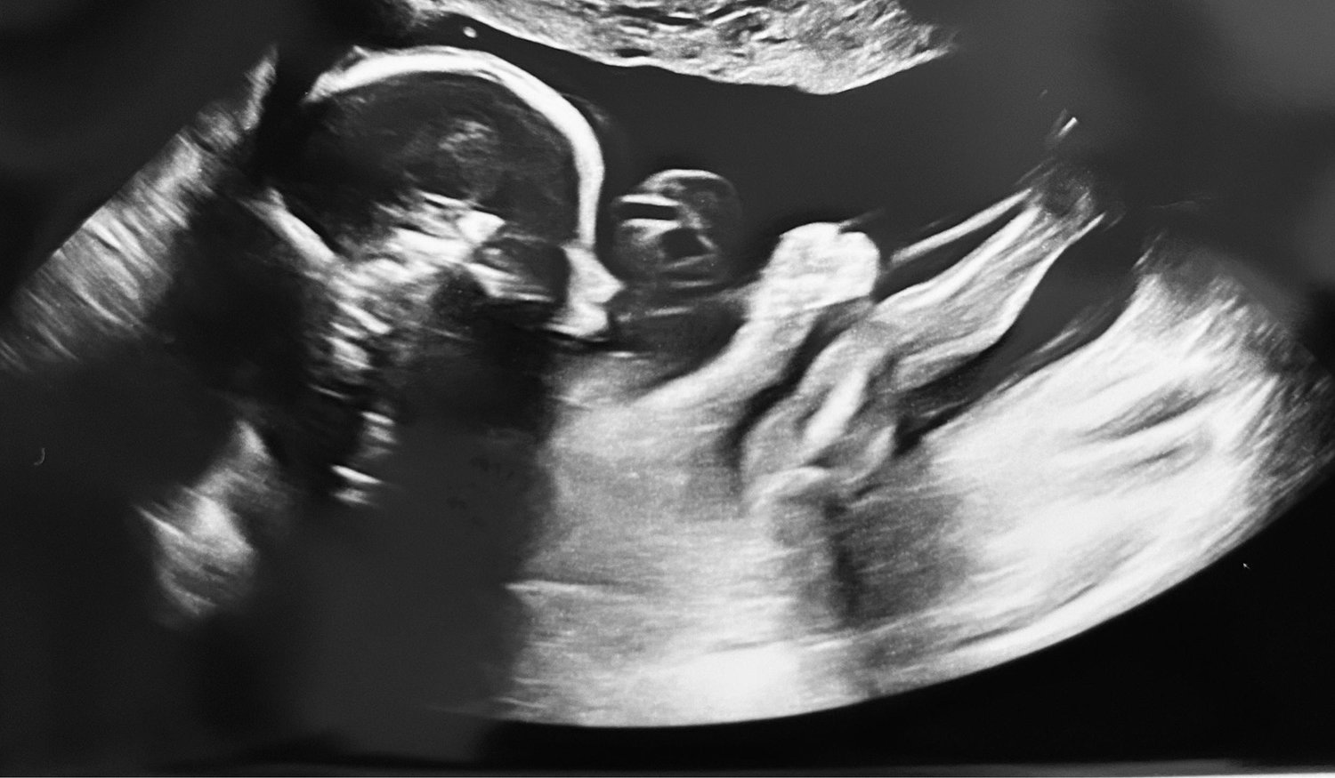The Wedding Website of ASHLEY BLOSSER Blosser and BABY to be