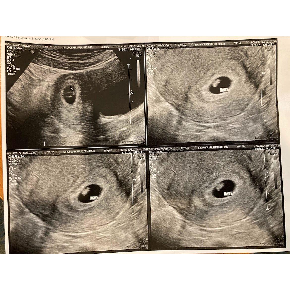 First picture of William, 6 weeks old.