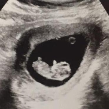 Hello, Baby!