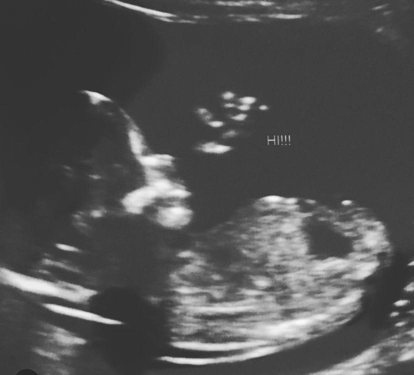 Only a few months later we had an unexpected surprise