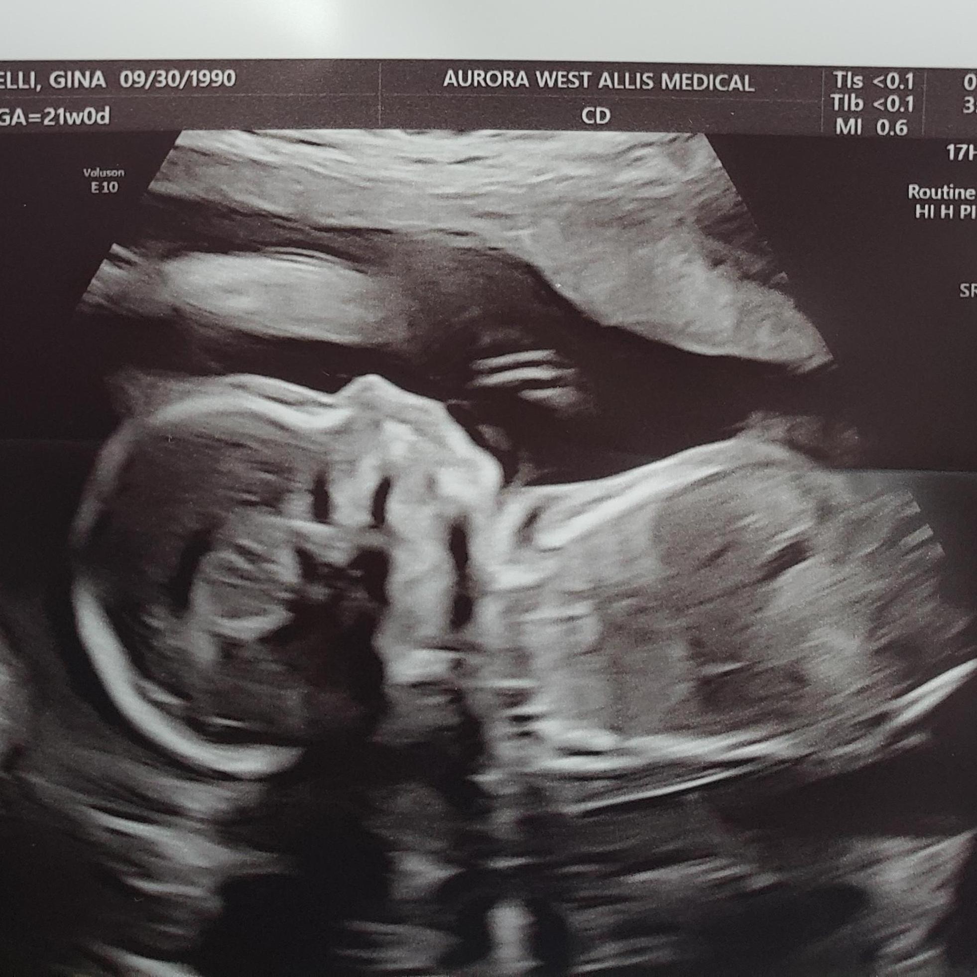 Our 21 week ultrasound. Looks like he might be stuck with the Leonardelli nose