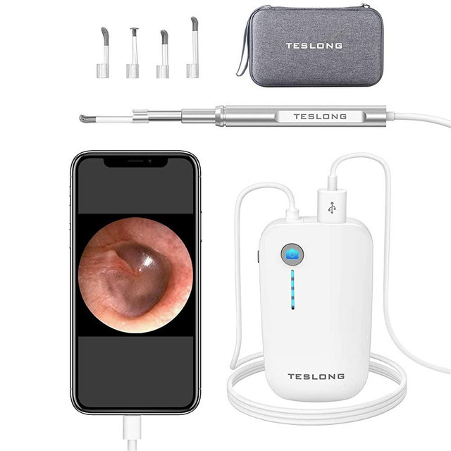 Otoscope Ear Buddies Ear Cleaner, Teslong USB Ear Camera, Digital Otoscope Camera, HD Video Ear Scope, Ear Wax Removal Tool with LED Light for iPhone, Android Phone, Adult, Self, Child, Dogs for Home