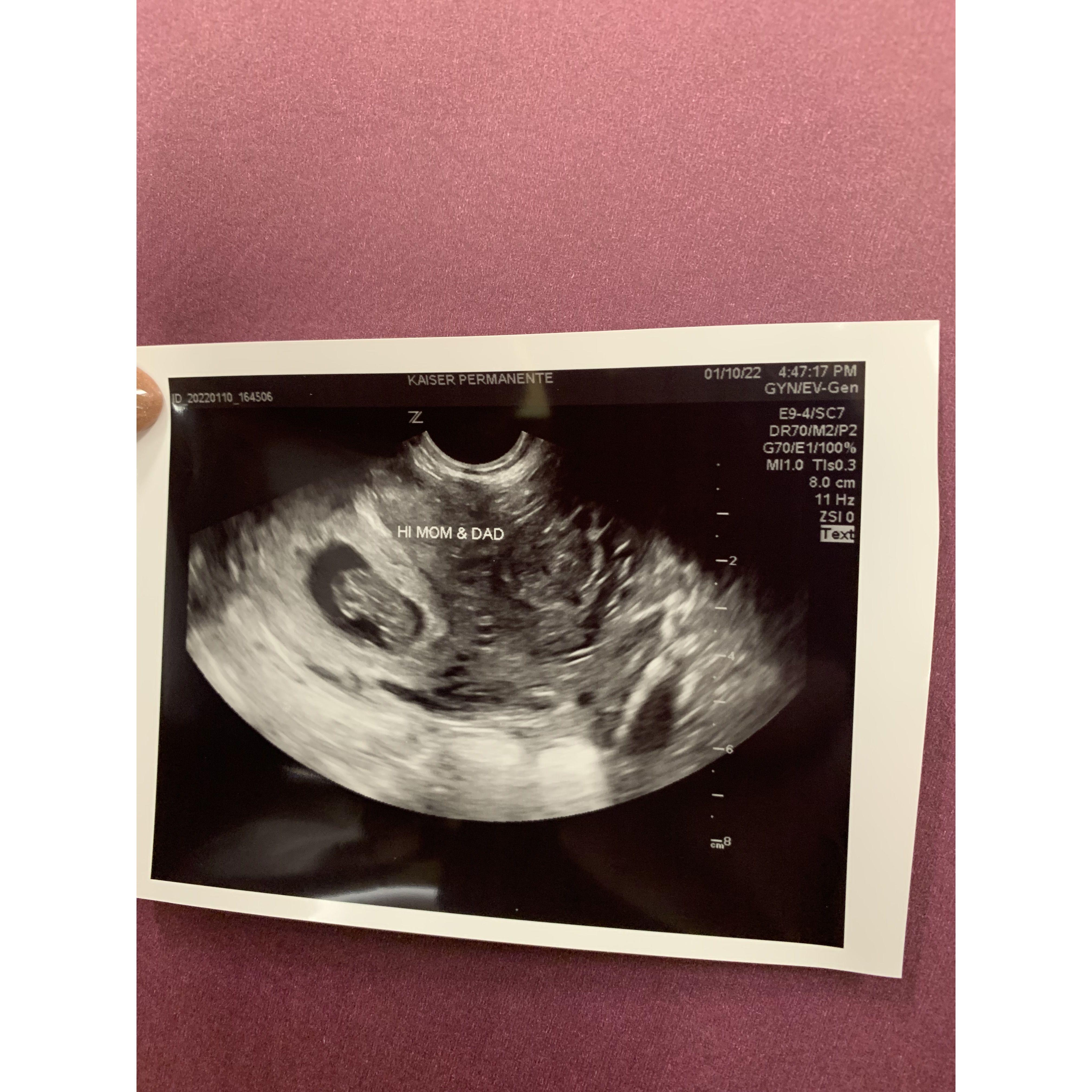 After our trip to Florida sure enough Andrew finds out he will be dad for the first time.