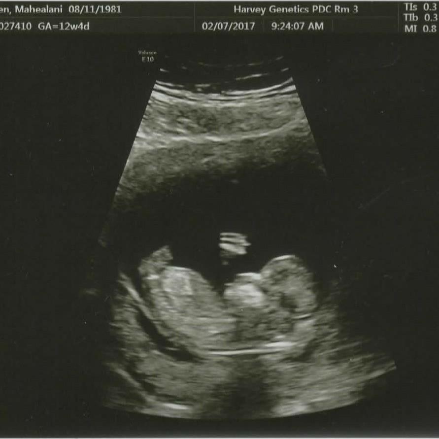 Fist Pump: Our Greatest Adventure to Come!