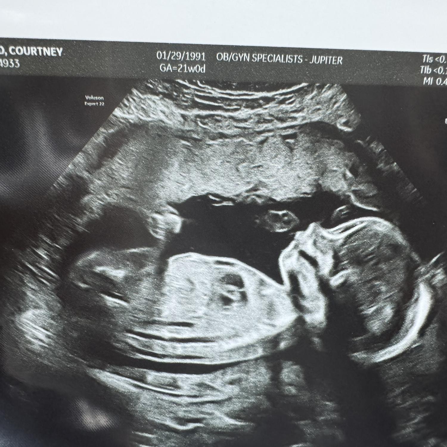 21 week Update!
