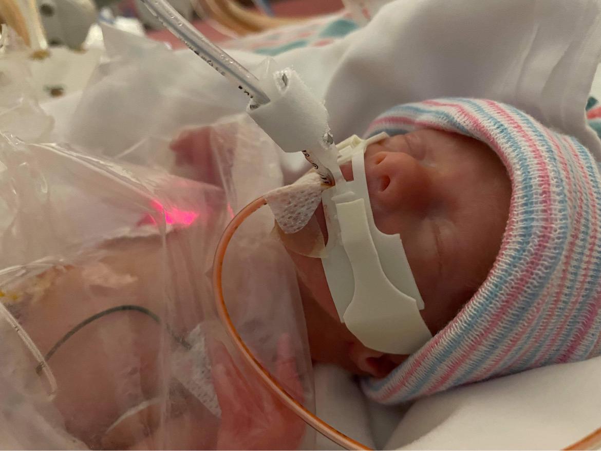 Rowen was born 13 weeks early 🥺❤️