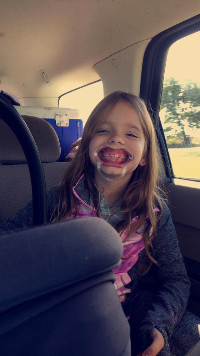 Say Cheeeeese!