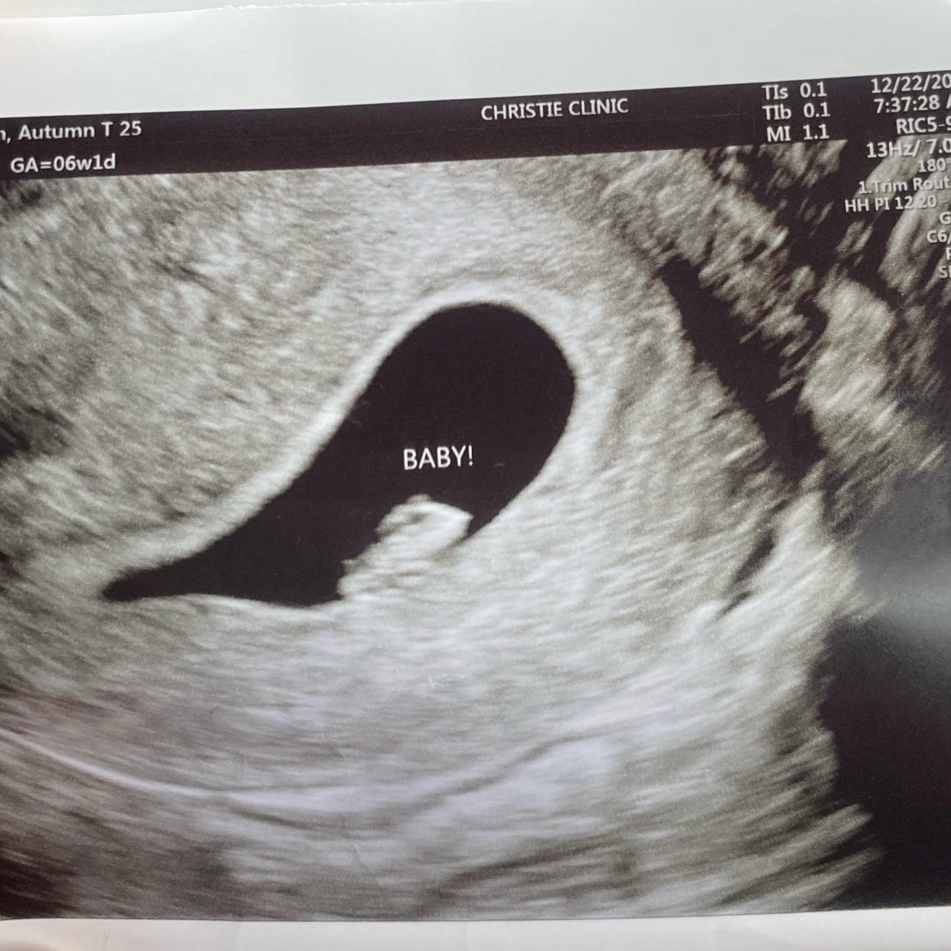 December 2022 our life changed forever 🤍