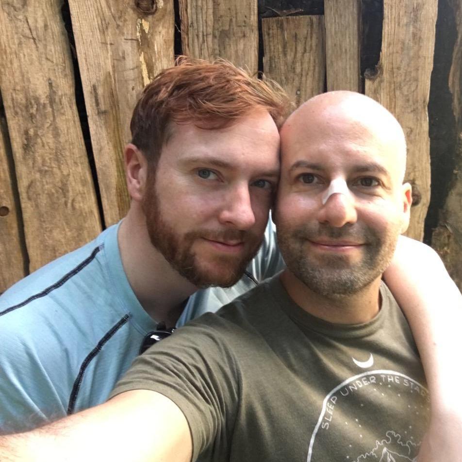 While camping, Matt decided to chop some wood with an axe for the first time. Three minutes later, he has a permanent scar on his nose.