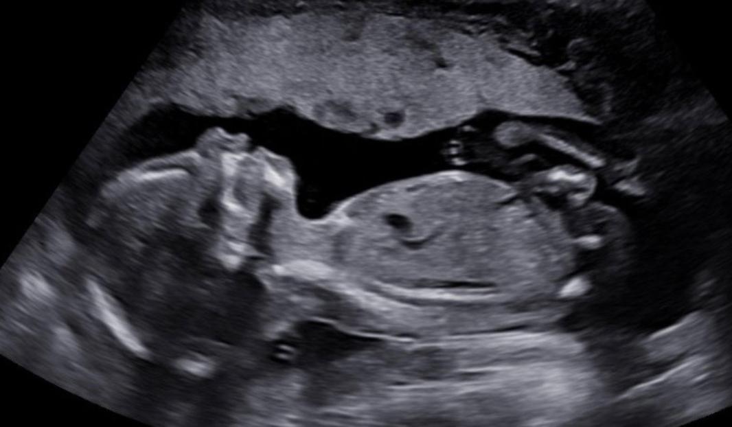 5bc3ff14-2a35-4f1f-8fd8-a5cf45027622