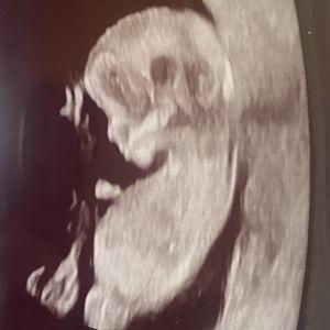 Baby McAteer's 529 Account