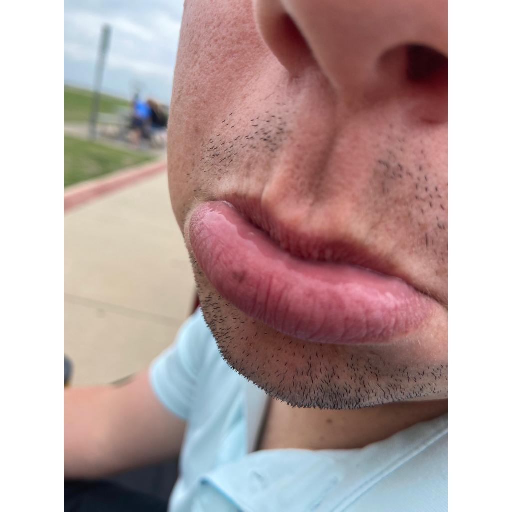 Favorite part - a Heart freckle