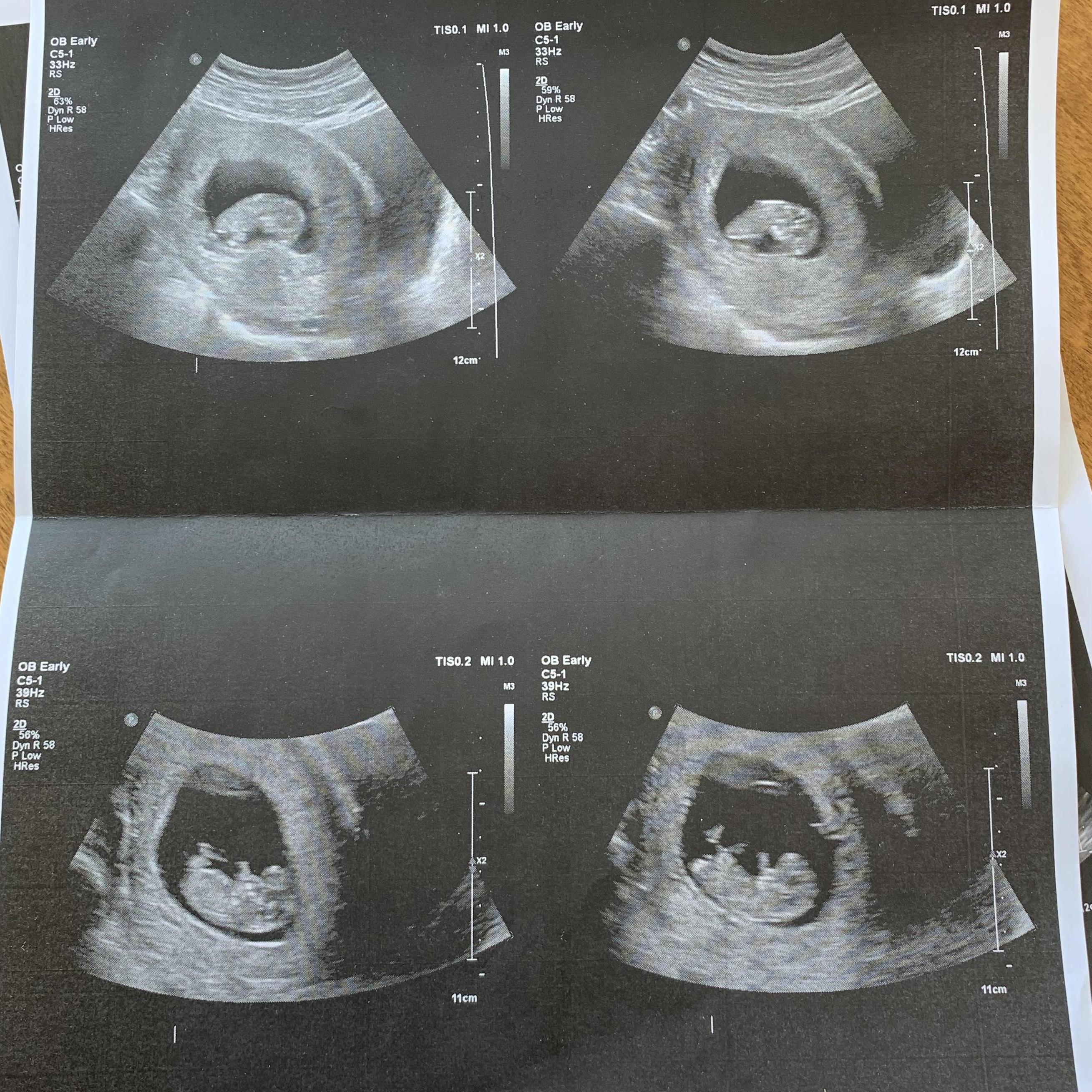 10 weeks!