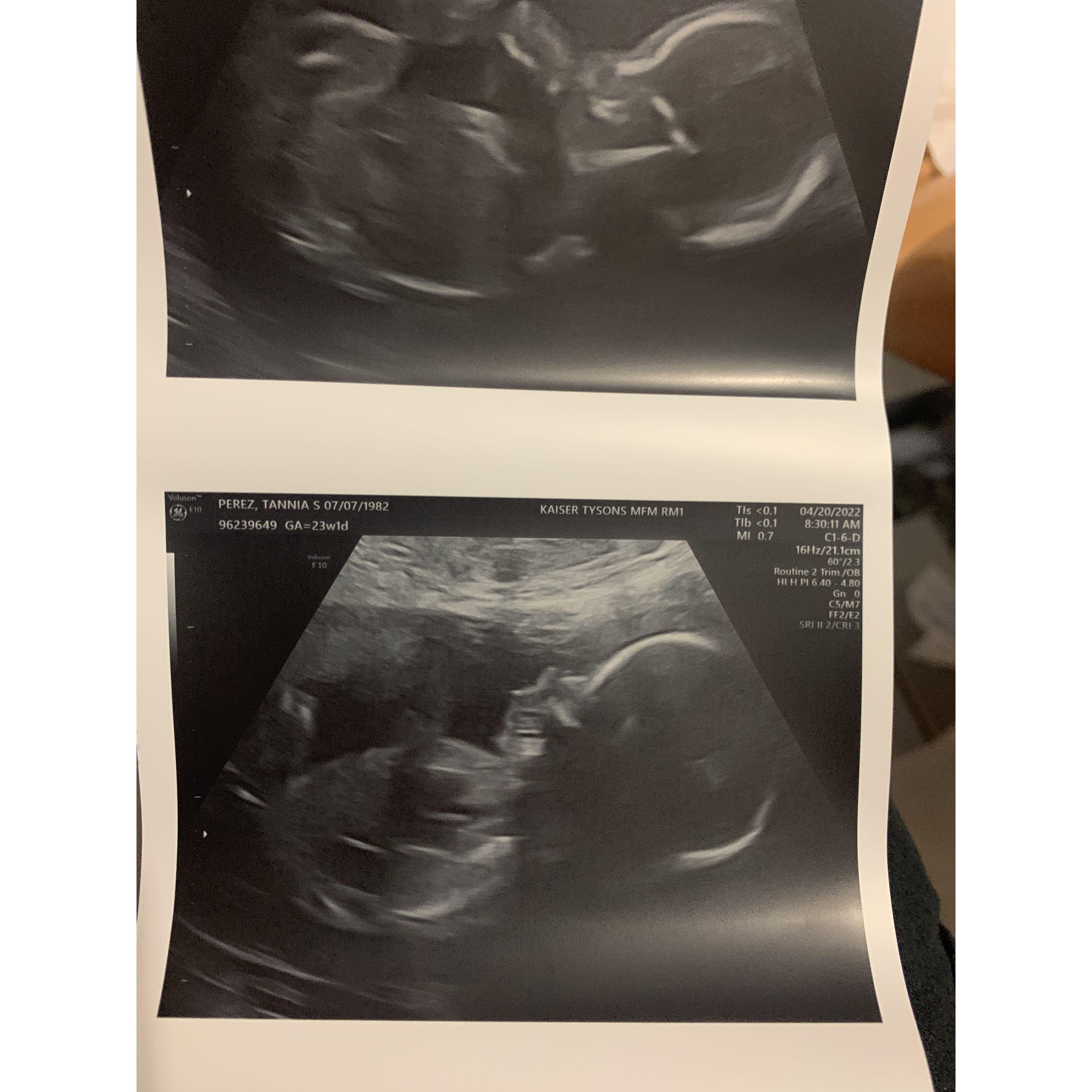 Baby still cooking in the oven we find out he is a boy