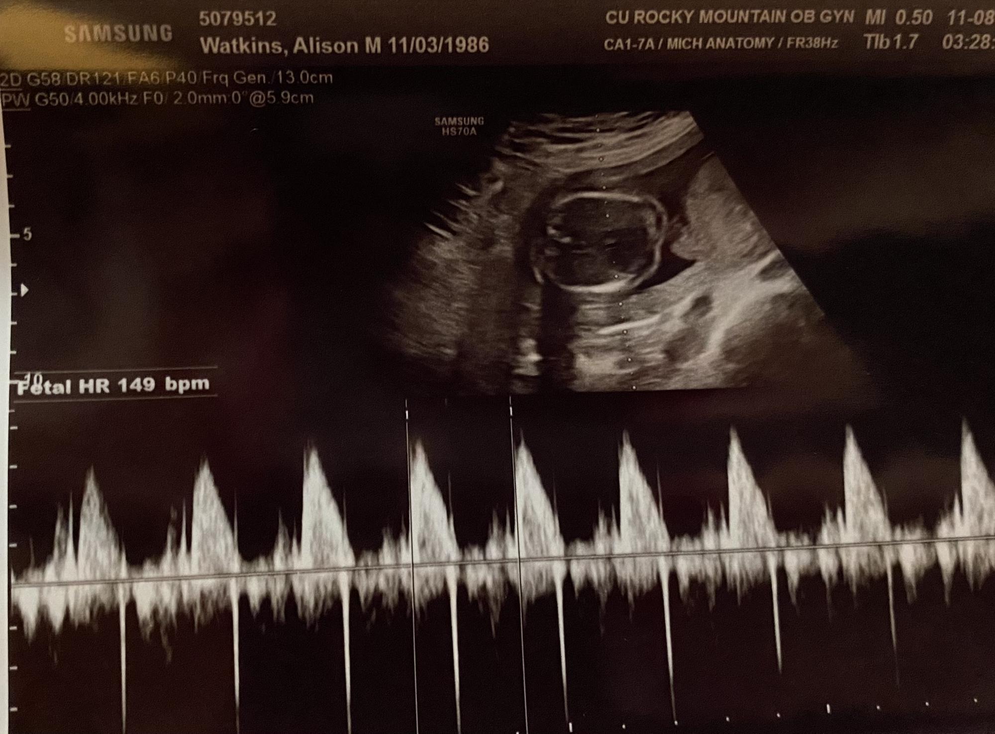 Her healthy heartbeat