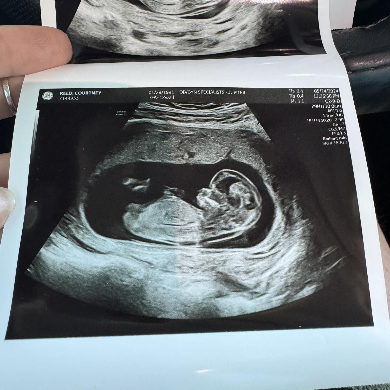 Baby Casey 12 weeks