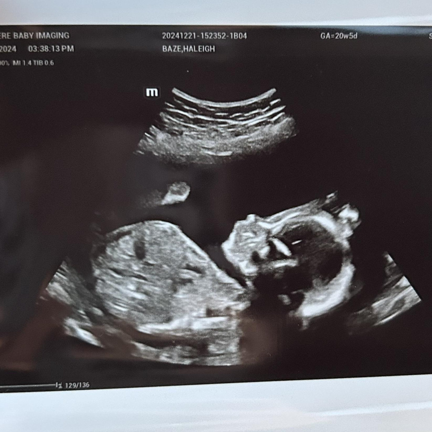 pregnant!!!! ❤️