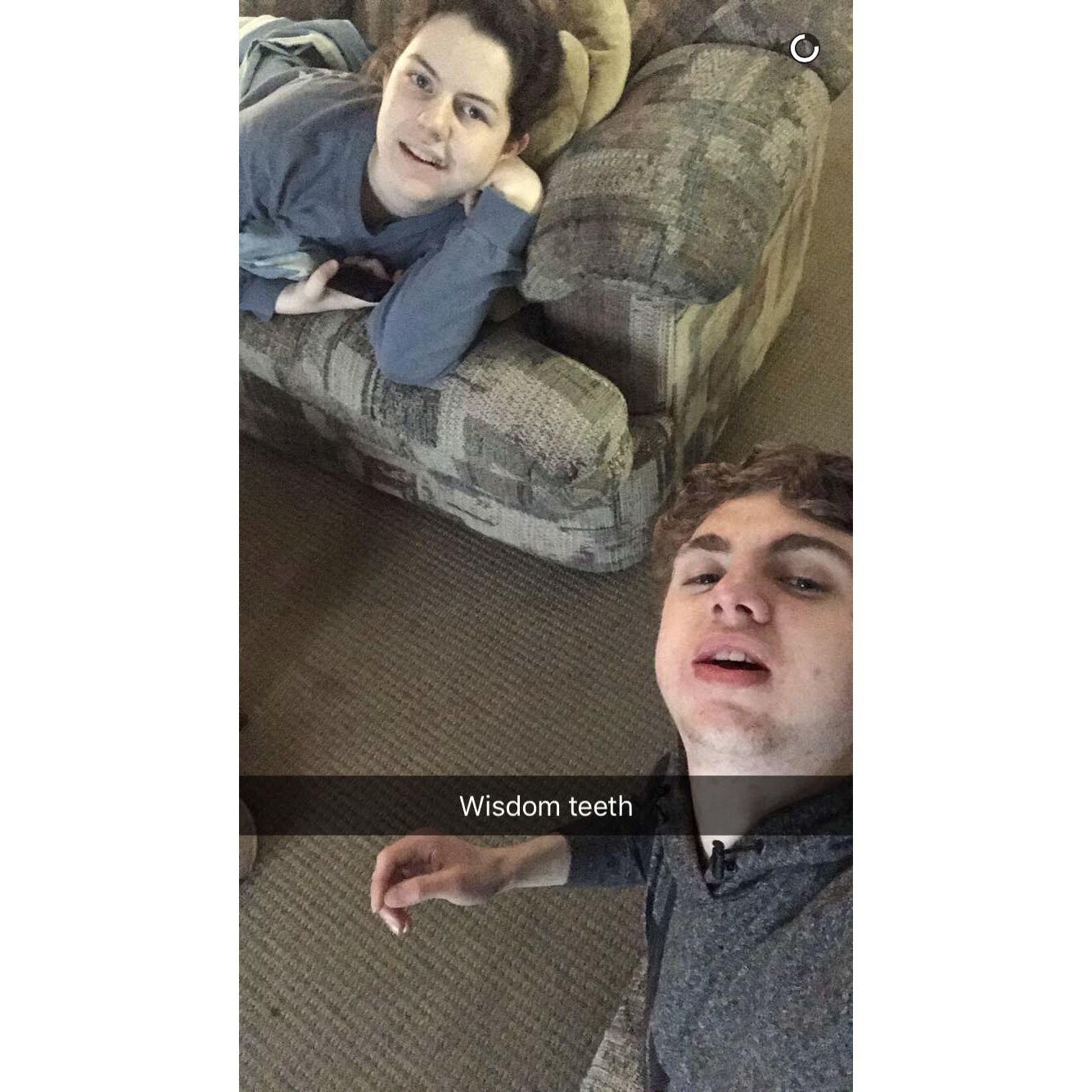 (2018) We both got our wisdom teeth out on the same day and went back to Dave's house to be miserable and heal together