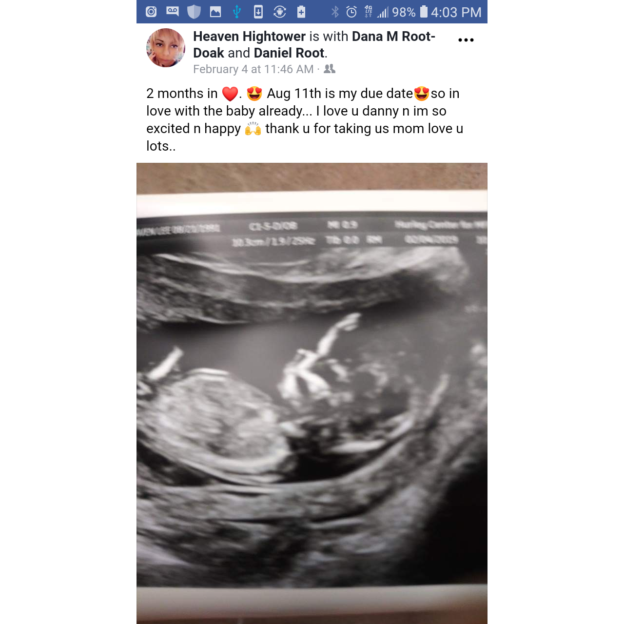 Are first babies visit,But it was one of the best days of our lives. As we stare astonished at the life we were looking at right in front of our eyes. now our family and our future finally begins