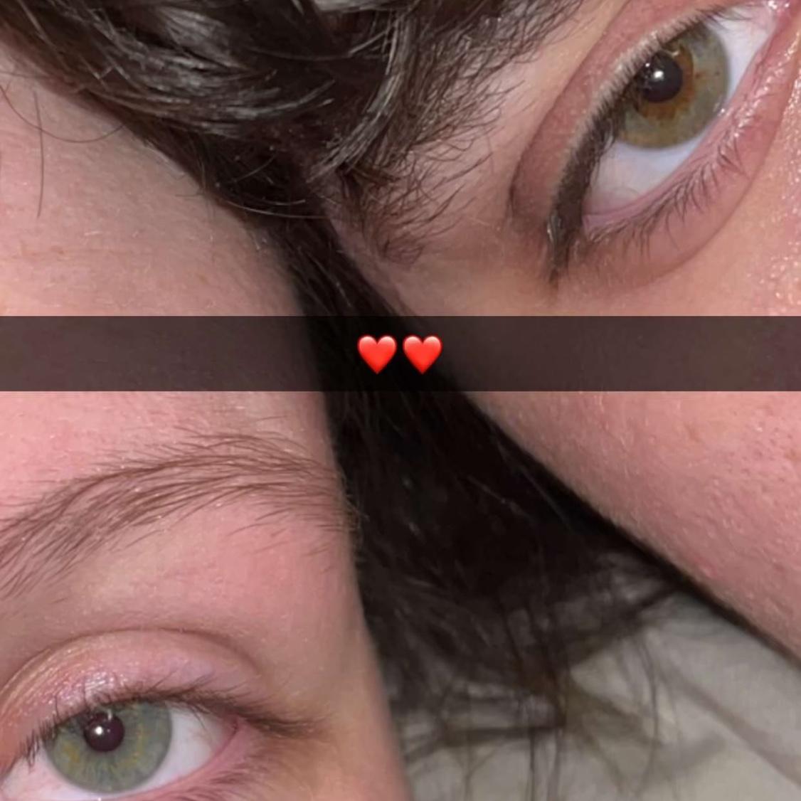 Our eyes ❤️❤️